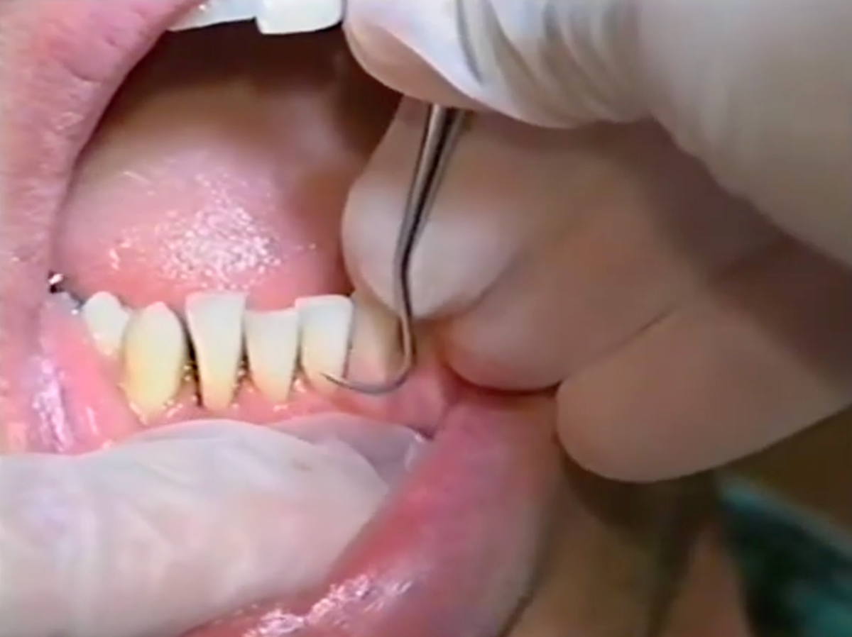 De raad wilde een 'tandenfee', maar actie bleef uit