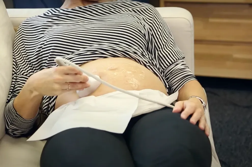 BabyWatcher technologisch compleet vastgelopen