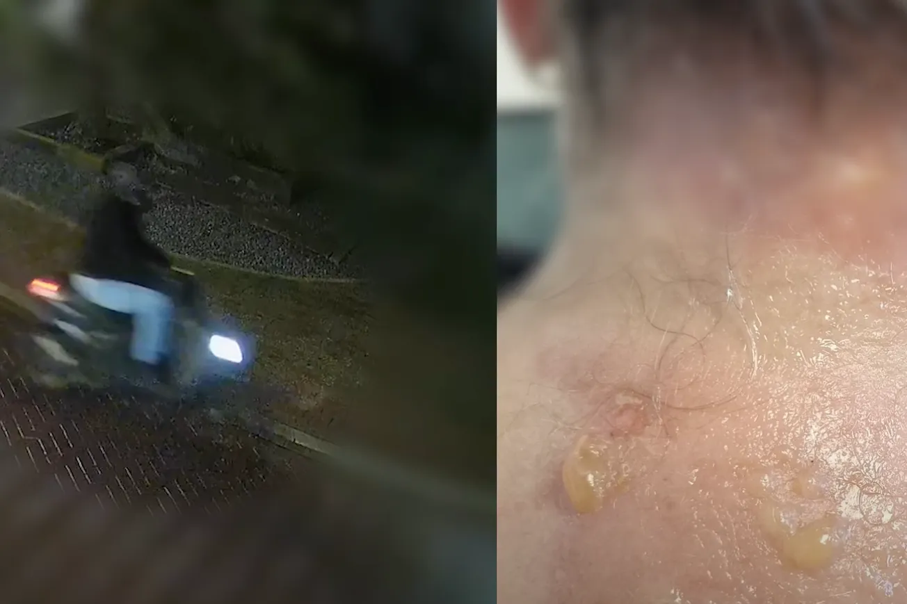 Politie deelt beelden van mishandeling met hete vloeistof